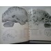 ATLAS DE VASCULARISATION ARTERIELLE DU CERVEAU CHEZ L'HOMME - ATLAS OF THE ARTERIES OF THE-HUMAN-BRAIN -  G. SALAMON (franceza si engleza)